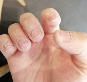 fingers